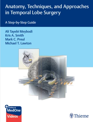 Anatomy, Techniques, and Approaches in Temporal Lobe Surgery: A Step-by-Step Guide